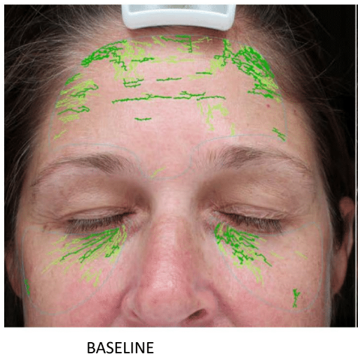 ALASTIN Restorative Skin Complex