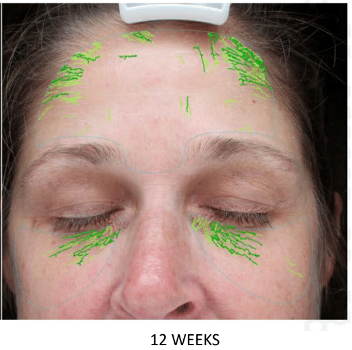 ALASTIN Restorative Skin Complex