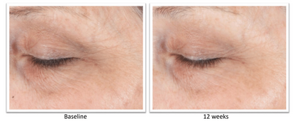 ALASTIN Restorative Eye Treatment