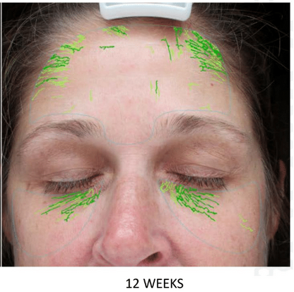 ALASTIN Restorative Skin Complex
